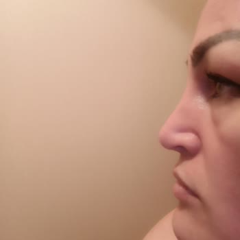 Özel Ekol Hastanesi (İzmir) Yanlış Yapılan Ameliyat