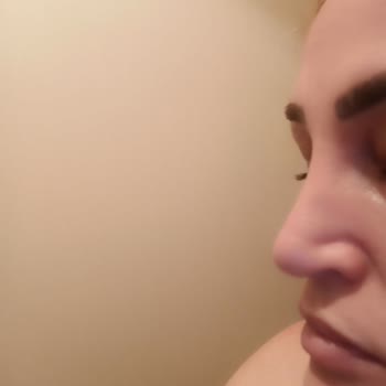 Özel Ekol Hastanesi (İzmir) Yanlış Yapılan Ameliyat