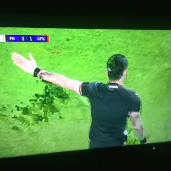Tod TV 1 Kanalı Pixel Kaybı, Karıncalanma