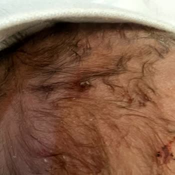 Sincan Lokman Hekim Hastanesi: Yanıltıcı Ve İyi Olmadığı Halde Devletten İyi Olur Düşüncesiyle Doğum Paketi Aldım