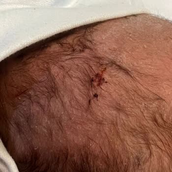 Sincan Lokman Hekim Hastanesi: Yanıltıcı Ve İyi Olmadığı Halde Devletten İyi Olur Düşüncesiyle Doğum Paketi Aldım