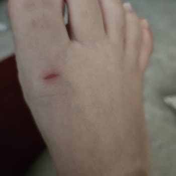 Slipstop Ayakta Yara Yapan Deniz Terliği