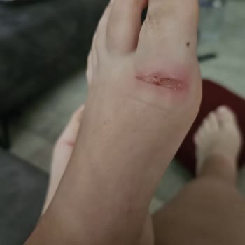 Slipstop Ayakta Yara Yapan Deniz Terliği