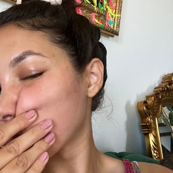 Mineaderm Ürün Yüzümü Mahvetti