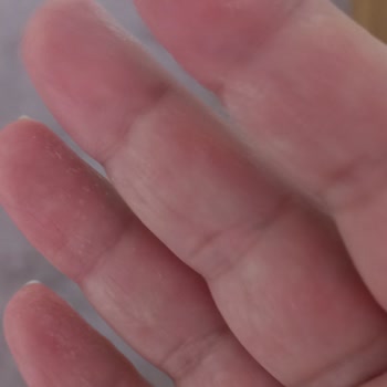 Duru Sabun Tahrişe Yol Açtı!