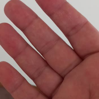 Duru Sabun Tahrişe Yol Açtı!