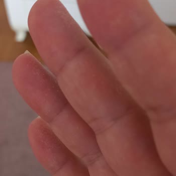 Duru Sabun Tahrişe Yol Açtı!