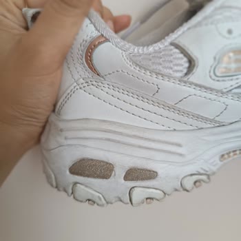 Skechers Beyaz Ayakkabımın Pulları Döküldü Kimse İlgilenmedi