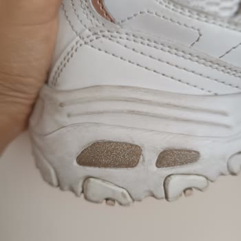 Skechers Shoes Falling Apart Within Months