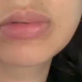 Pınar Onur Official Dudak Vitamin İşlemi