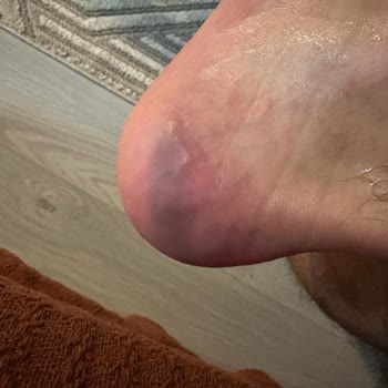 Boyner Valentino  Ayakkabıyla İlgili Şikayetim