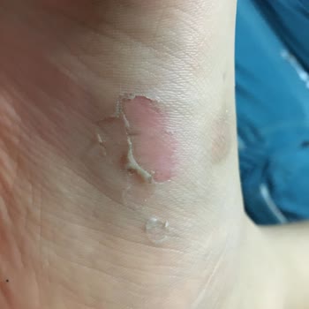 Ortopedia Ayakkabıları Kalitesiz Ve Deri Falan Değil