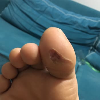 Ortopedia Ayakkabıları Kalitesiz Ve Deri Falan Değil