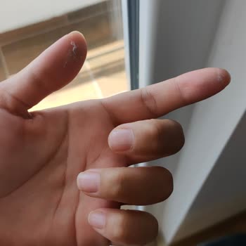 Mutlu Temizlik (Kayseri) Fiyaskosu