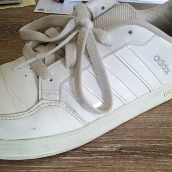 Koray Spor Adidas Marka Ayakkabının 1 Ayda Önünün Açılması
