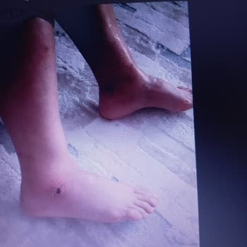 Op. Dr. Eren Anğ Varis İle İlgili Yaşadığım Problem