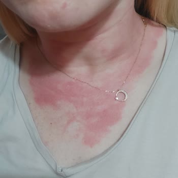 Sadece Tuborg Gold Kaşıntı Yapıyor