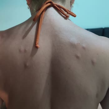 Saros Aslan Apart Hotel Eksik Hizmet, Temizlik Sorunu