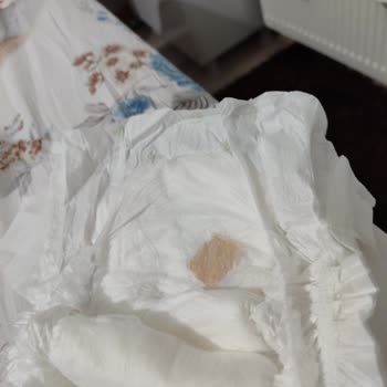 Baby Turco Hatalı Üretim Dikkatsizlik