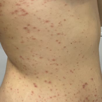 Bioblas Şampuan Alerji Kaşıntı Hastanelik