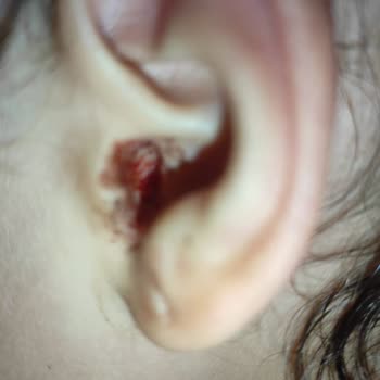 Lykia World Hijyen ve Temizlik Sıfır