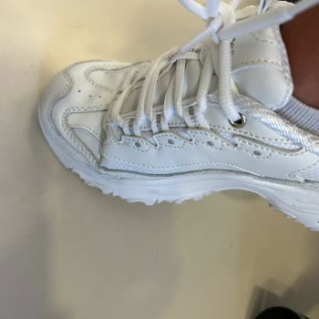 Skechers Kusurlu Ayakkabı Satışı Yaptı Ürün İadesini Almıyor,