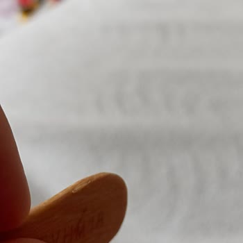 Algida Magnum Dondurma Çubuk Kırıklığı