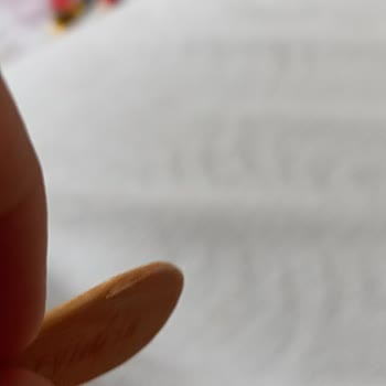 Algida Magnum Dondurma Çubuk Kırıklığı