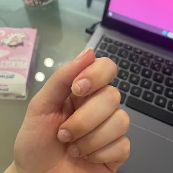 Selin Beauty Center Güzellik Merkezi Adana Şubesinde Yaptırdığım Tırnağım Kırıldı