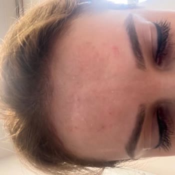Erdinç Batal Beauty Tehdit Ve Mağduriyet