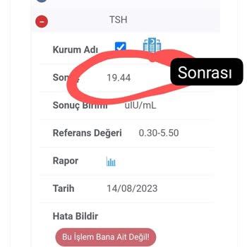 Royal Hastanesi Yanlış Teşhis ( Doktor İhmali )