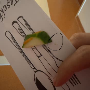 Sanko Üniversitesi Hastanesi Yemekler Memnun Olmaktan Ziyade Bakteri Yuvası