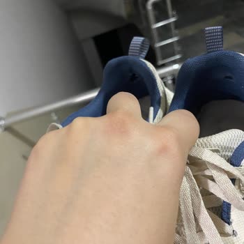 Skechers Markası Aldığı Parayı Hak Etmiyor
