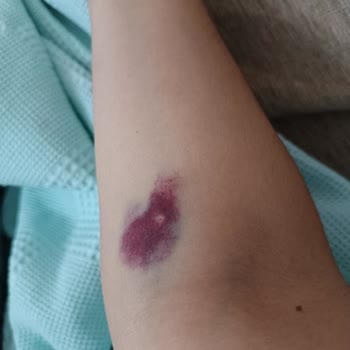 Özel Menemen Yaşam Tıp Merkezi Personellerin Yetersiz İlgisi Ve Yanlış İşlem Yapmaları