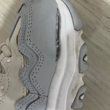 Skechers Kalitesiz Üretilen Ayakkabı