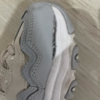 Skechers Kalitesiz Üretilen Ayakkabı