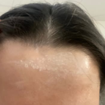 S'HE Vec Bozuk Ürün Yüzümü Mahvetti