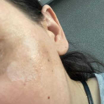 S'HE Vec Bozuk Ürün Yüzümü Mahvetti