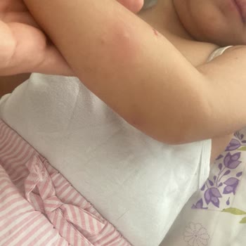 Gaziantep Büyükşehir Belediyesi Gaziantep Büyükşehirde İlaçlama Yok