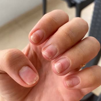 Elif Erkol Nail Spa'dan Şikayetçiyim