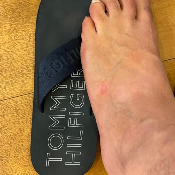 Tommy Hilfiger Tomy Terlik Şikayetim Var.