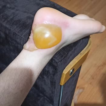 Cooker Termos Kapak Sorunu