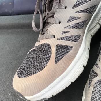 Skechers Ayakkabı Renk Atması Ve Firmanın Kabul Etmemesi