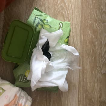 Baby Turco Paketten Çıkan Yabancı Cisim