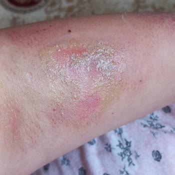 Nilu Moda Trendyol'dan Aldığım Ürünün Sonucu Kötü