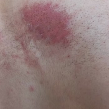 Nilu Moda Trendyol'dan Aldığım Ürünün Sonucu Kötü