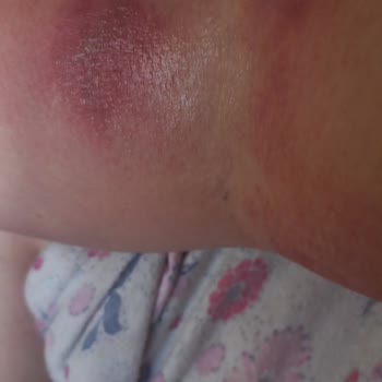 Nilu Moda Trendyol'dan Aldığım Ürünün Sonucu Kötü