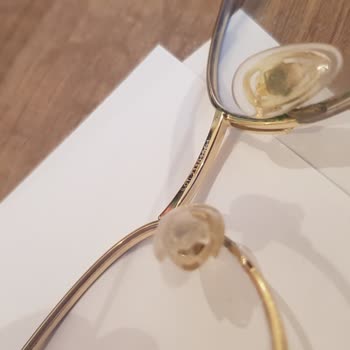 Atasun Optik Satış Sonrası İlgisizlik