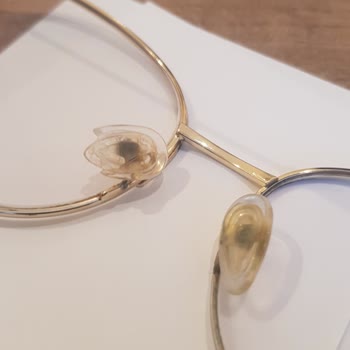 Atasun Optik Satış Sonrası İlgisizlik