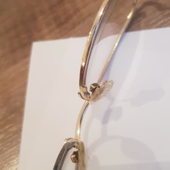 Atasun Optik Satış Sonrası İlgisizlik